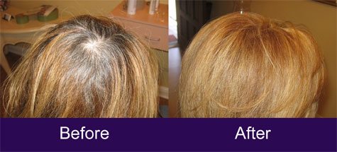 Your Highness before and after